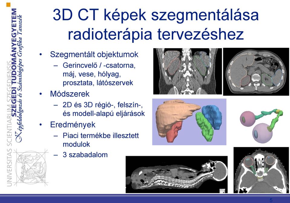 látószervek Módszerek 2D és 3D régió-, felszín-, és modell-alapú