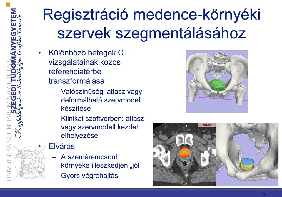 deformálható szervmodell készítése Klinikai szoftverben: atlasz vagy szervmodell