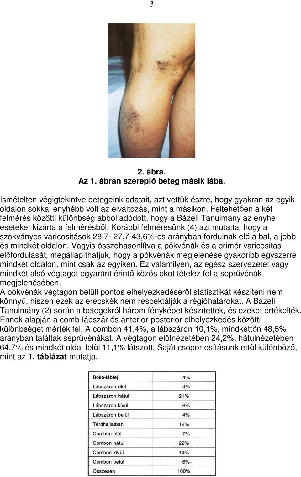 Korábbi felmérésünk (4) azt mutatta, hogy a szokványos varicositások 28,7-27,7-43,6%-os arányban fordulnak elı a bal, a jobb és mindkét oldalon.