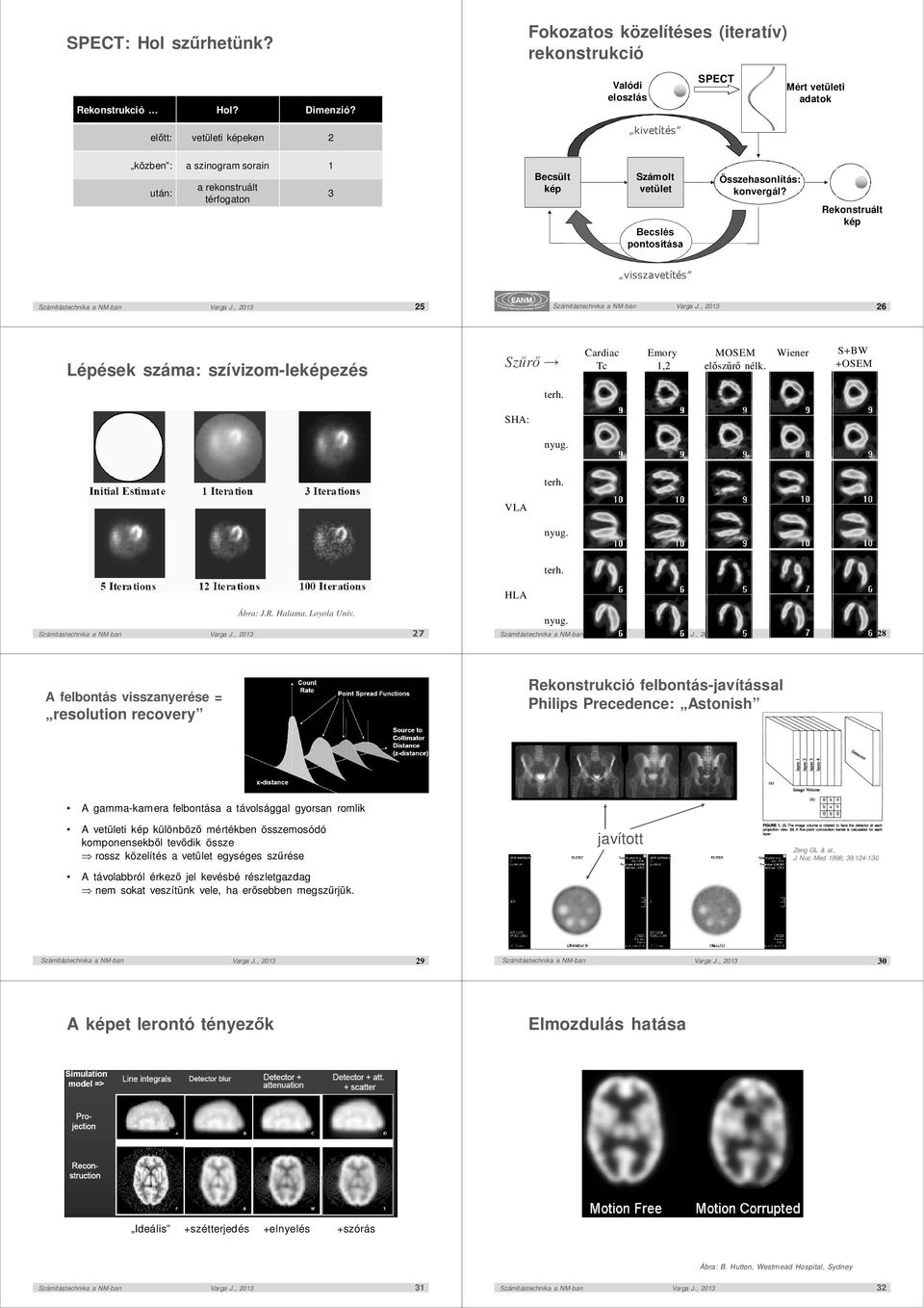 Rekonstruált kép Becslés pontosítása visszavetítés 25 Szűrő Lépések száma: szívizom-leképezés Cardiac Tc 26 Emory 1,2 MOSEM előszűrő nélk. Wiener S+BW +OSEM terh. SHA: nyug. terh. VLA nyug. terh. HLA Ábra: J.