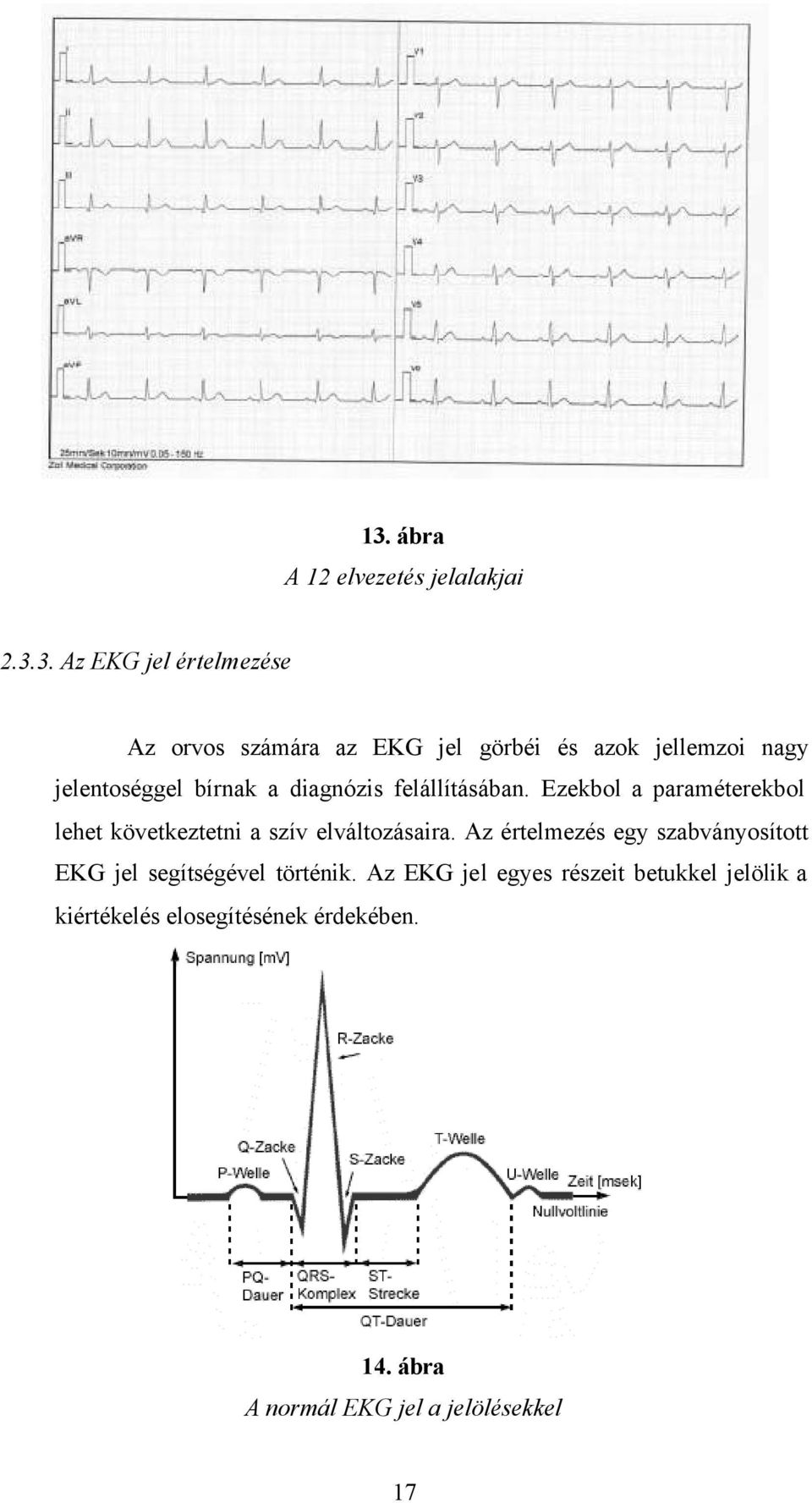 Ezekbol a paraméterekbol lehet következtetni a szív elváltozásaira.