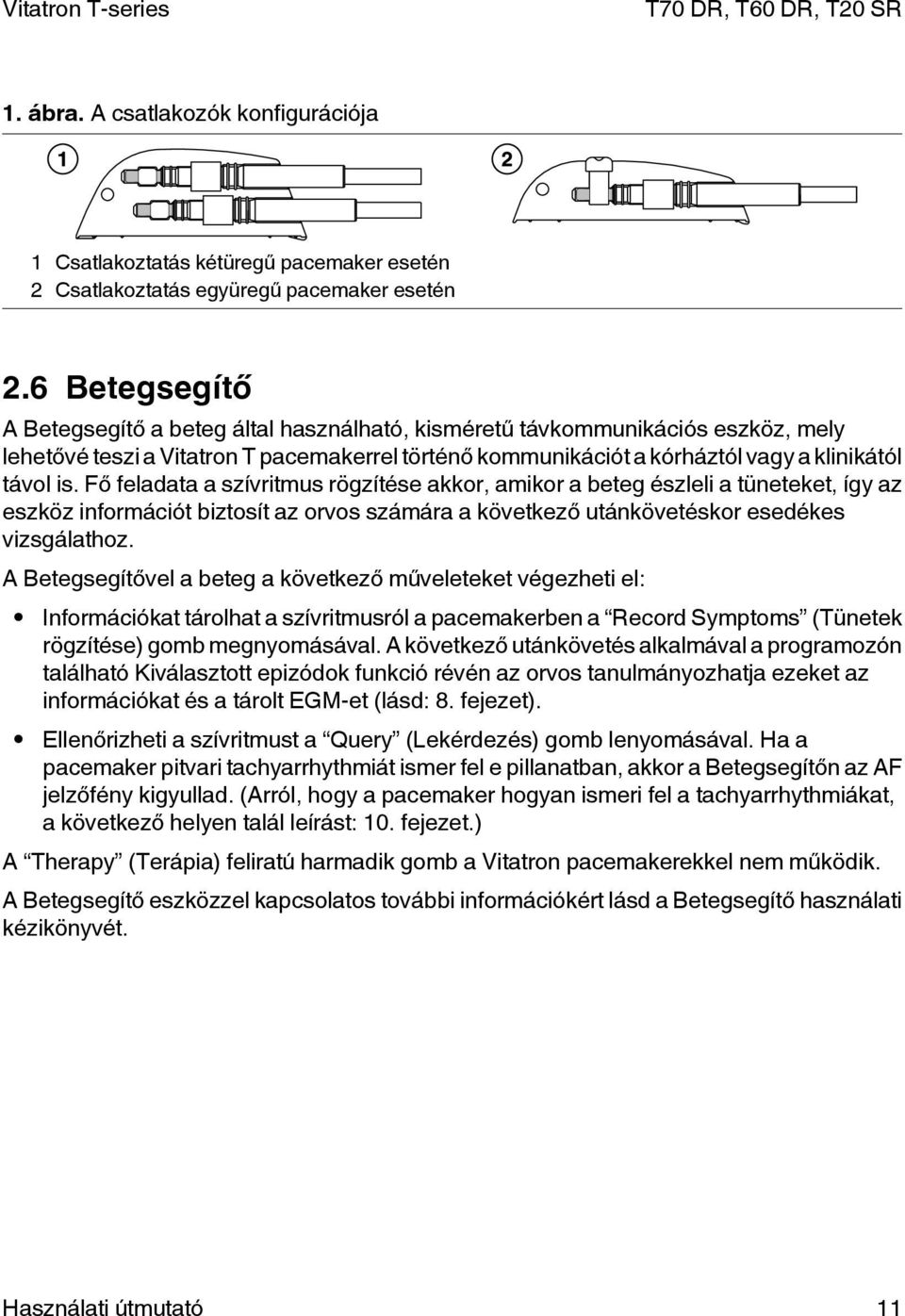 Fő feladata a szívritmus rögzítése akkor, amikor a beteg észleli a tüneteket, így az eszköz információt biztosít az orvos számára a következő utánkövetéskor esedékes vizsgálathoz.