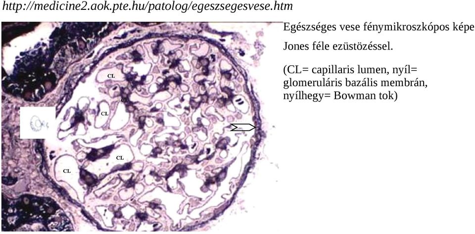 htm Egészséges vese fénymikroszkópos képe Jones