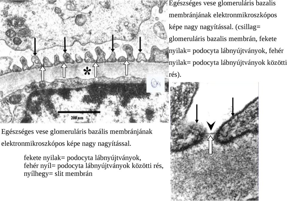 lábnyújtványok közötti rés).