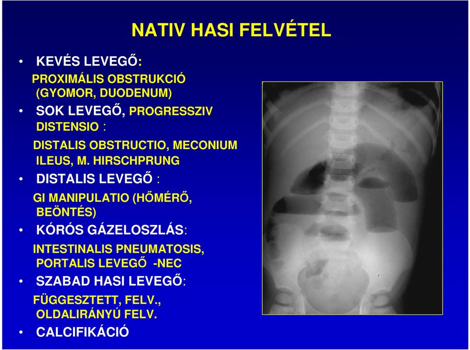 HIRSCHPRUNG DISTALIS LEVEGİ : GI MANIPULATIO (HİMÉRİ, BEÖNTÉS) KÓRÓS GÁZELOSZLÁS: