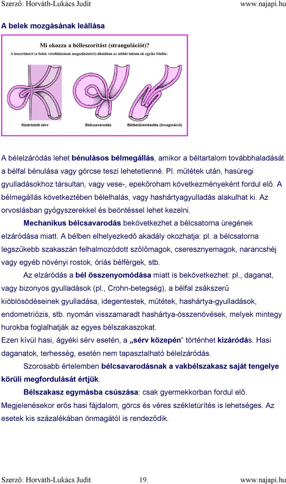 Az orvoslásban gyógyszerekkel és beöntéssel lehet kezelni. Mechanikus bélcsavarodás bekövetkezhet a bélcsatorna üregének elzáródása miatt. A bélben elhelyezkedő akadály okozhatja: pl.