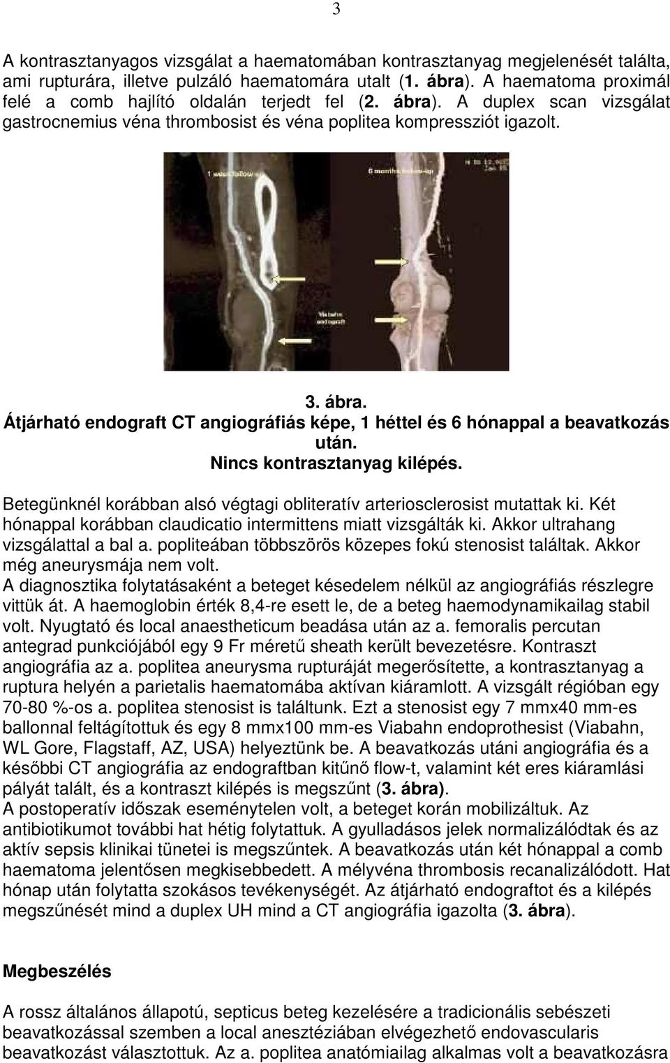 Nincs kontrasztanyag kilépés. Betegünknél korábban alsó végtagi obliteratív arteriosclerosist mutattak ki. Két hónappal korábban claudicatio intermittens miatt vizsgálták ki.