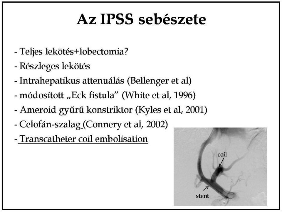 módosított Eck fistula (White et al, 1996) - Ameroid gyűrű