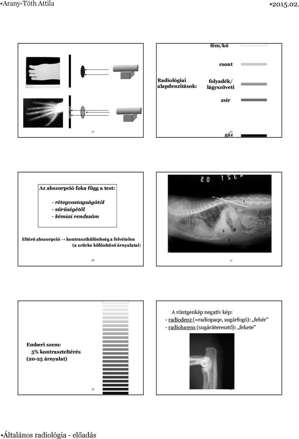felvételen (a szürke különböző árnyalatai) 5 3 2 38 41 A röntgenkép negatív kép: - radiodenz(=radiopaqe,