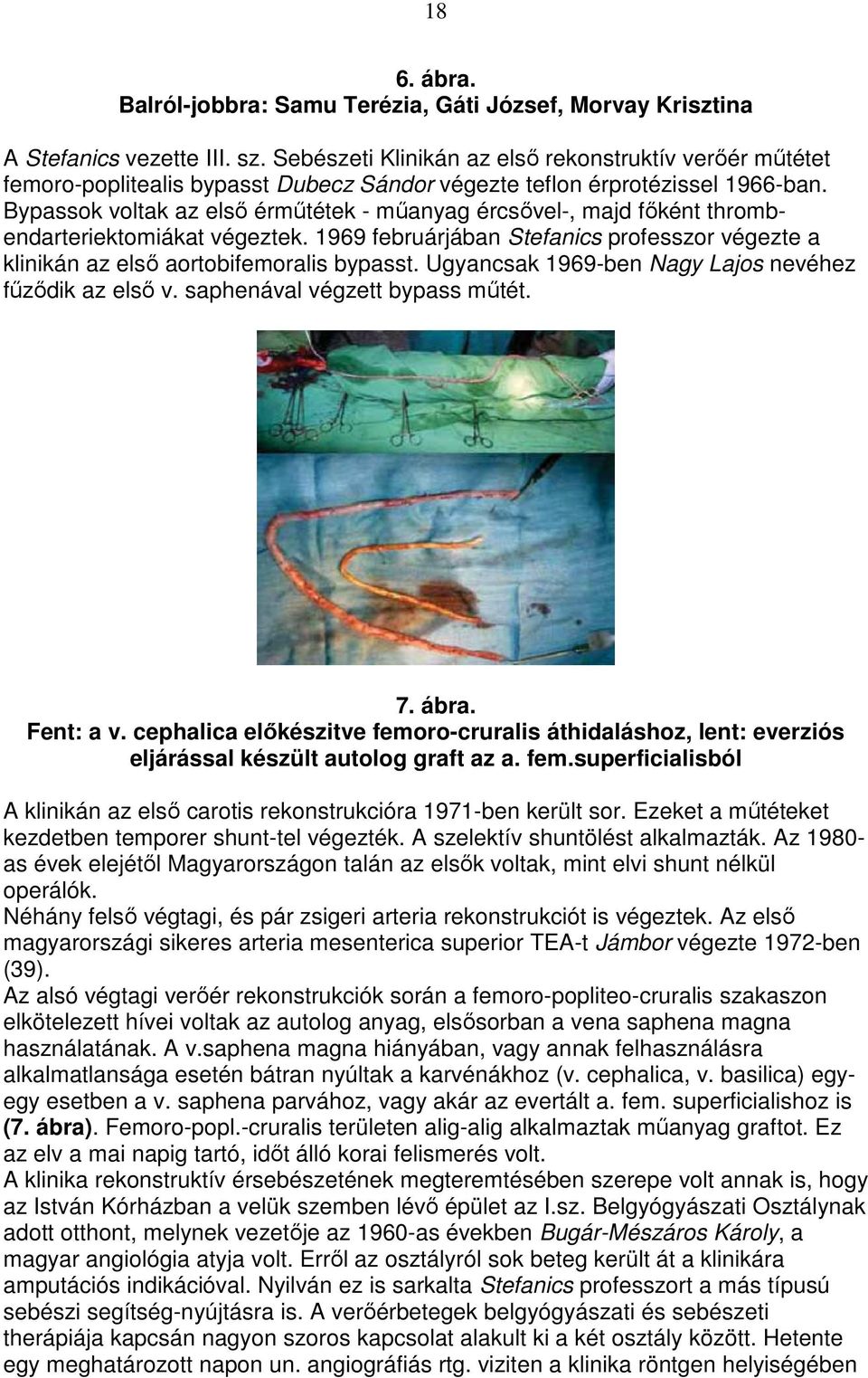 Bypassok voltak az első érműtétek - műanyag ércsővel-, majd főként thrombendarteriektomiákat végeztek. 1969 februárjában Stefanics professzor végezte a klinikán az első aortobifemoralis bypasst.