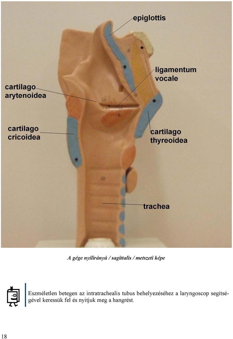 tubus behelyezéséhez a laryngoscop