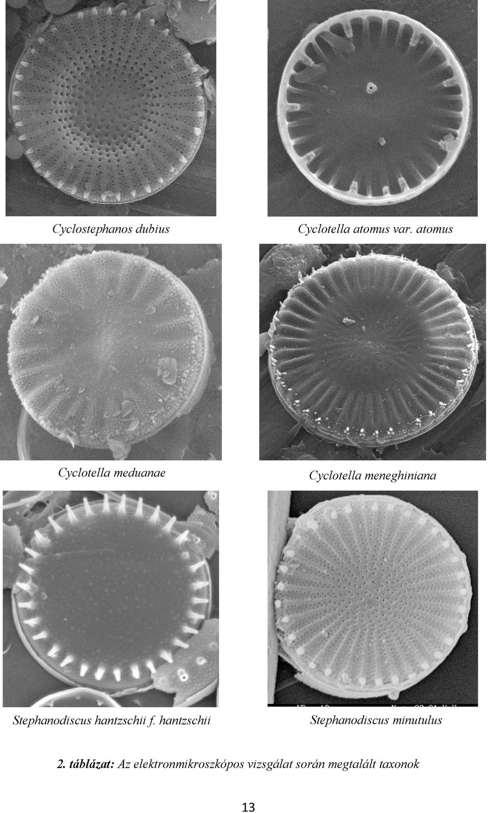 Stephanodiscus hantzschii f.