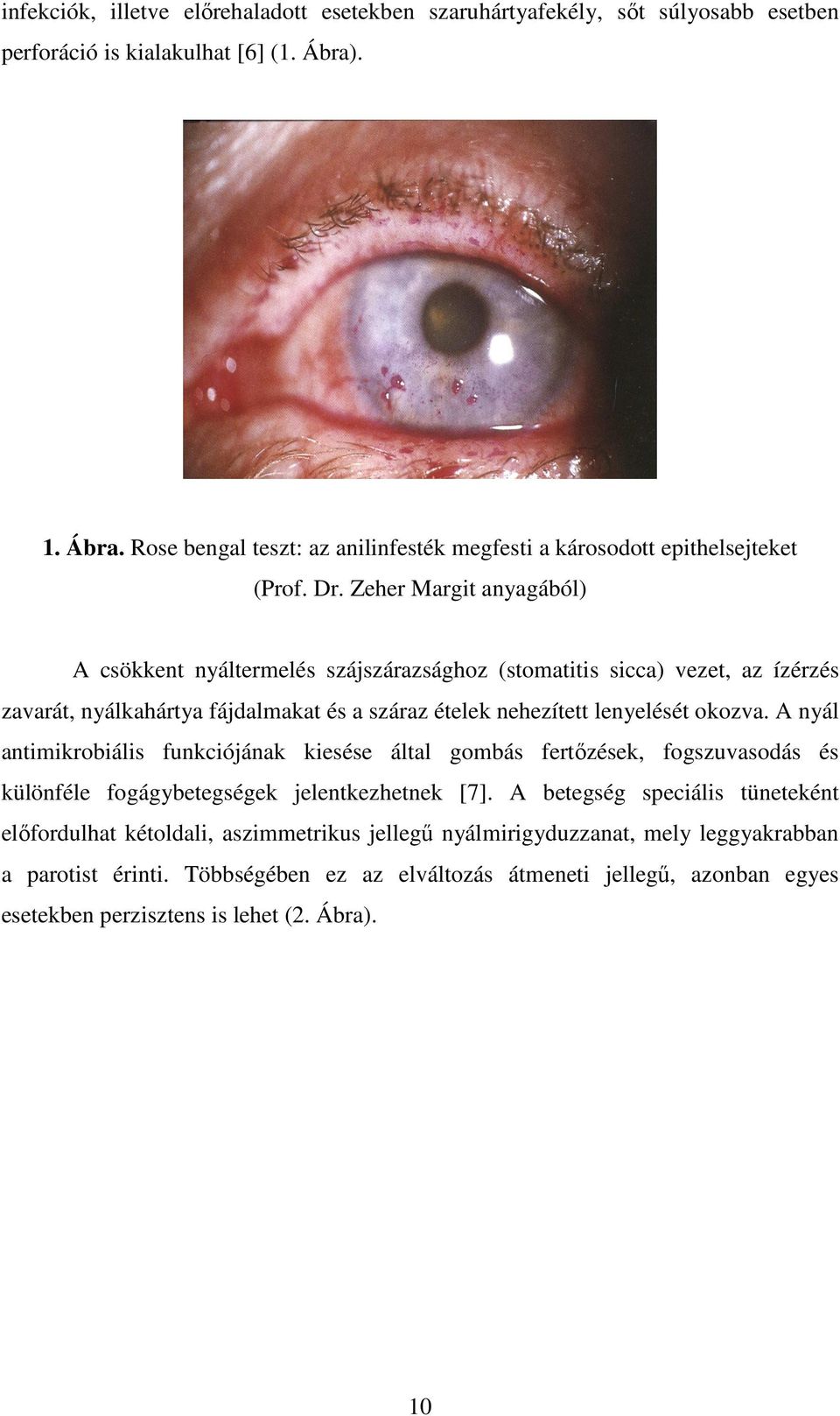 Zeher Margit anyagából) A csökkent nyáltermelés szájszárazsághoz (stomatitis sicca) vezet, az ízérzés zavarát, nyálkahártya fájdalmakat és a száraz ételek nehezített lenyelését okozva.