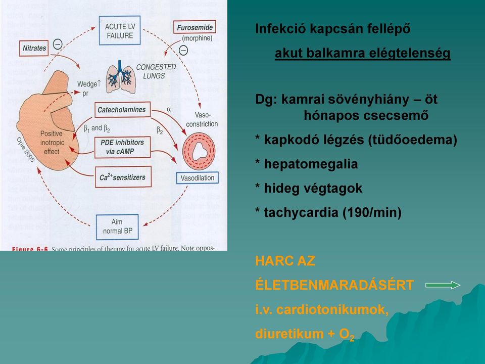 (tüdőoedema) * hepatomegalia * hideg végtagok * tachycardia