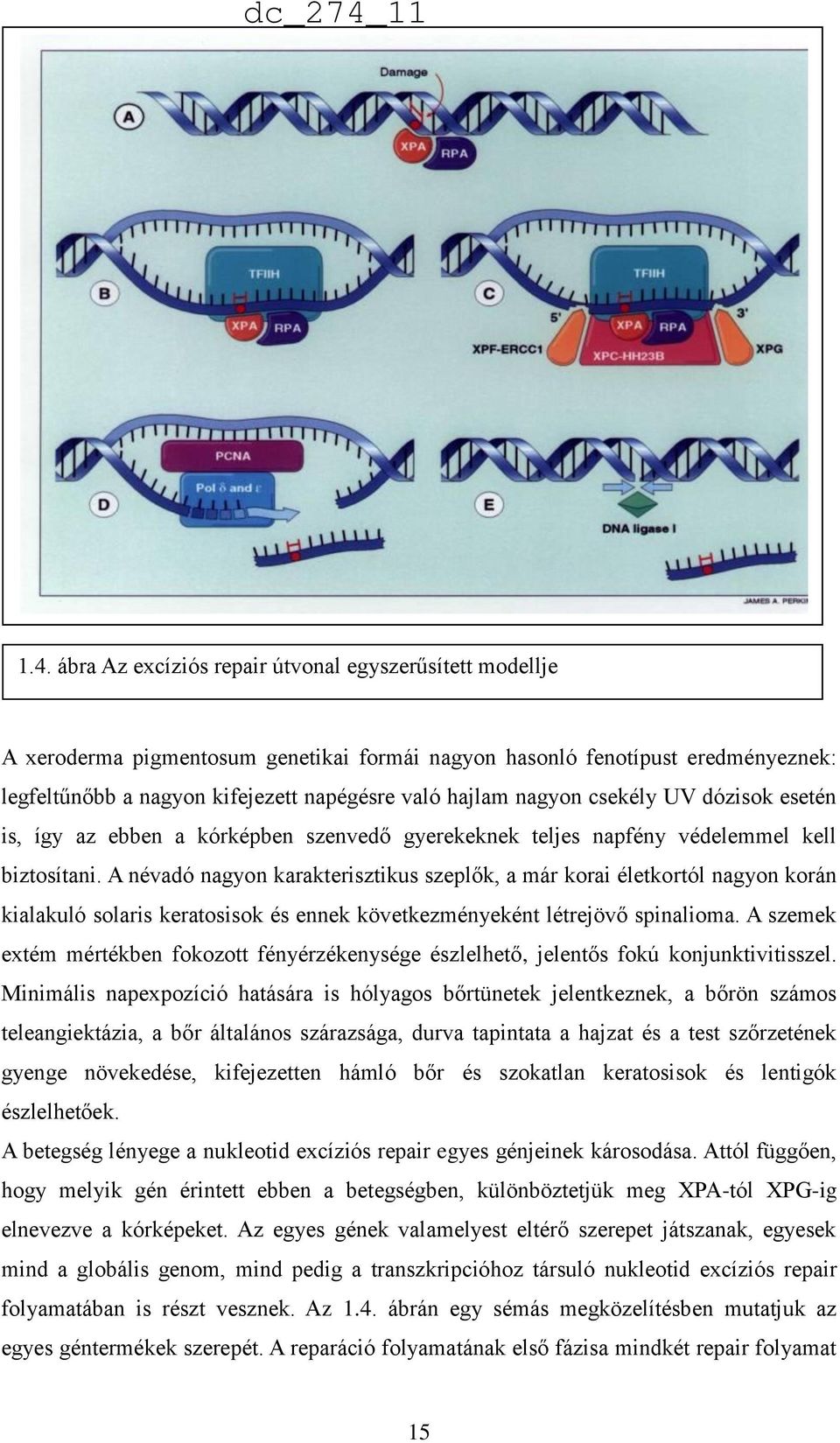 A névadó nagyon karakterisztikus szeplők, a már korai életkortól nagyon korán kialakuló solaris keratosisok és ennek következményeként létrejövő spinalioma.