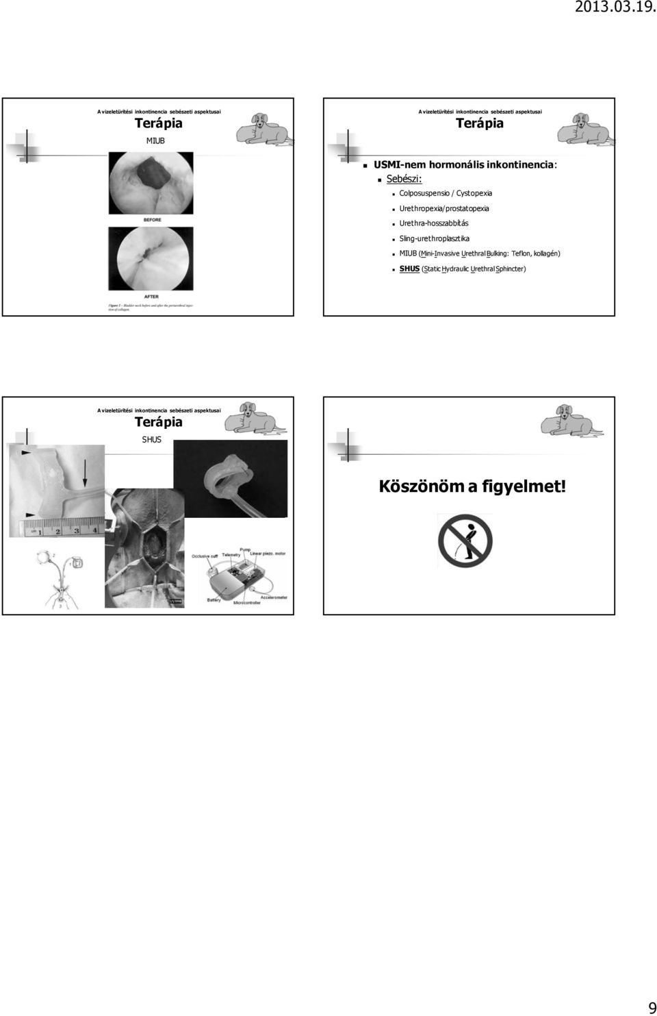 (Mini-Invasive Urethral Bulking: Teflon, kollagén)