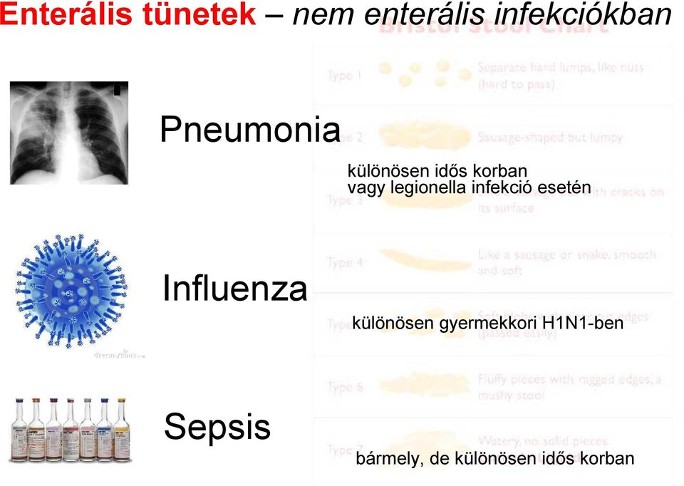 infekció esetén Influenza különösen gyermekkori