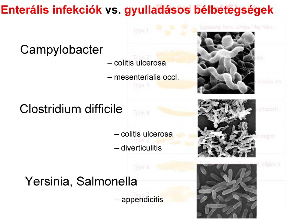 colitis ulcerosa mesenterialis occl.