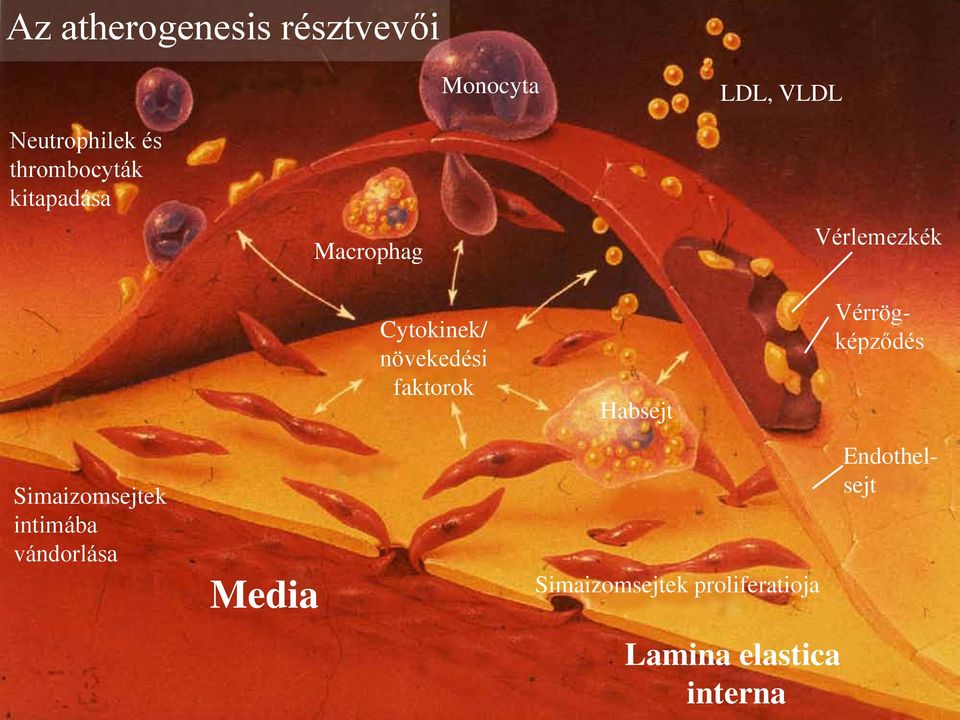 faktorok Habsejt Vérrögképződés Simaizomsejtek intimába vándorlása