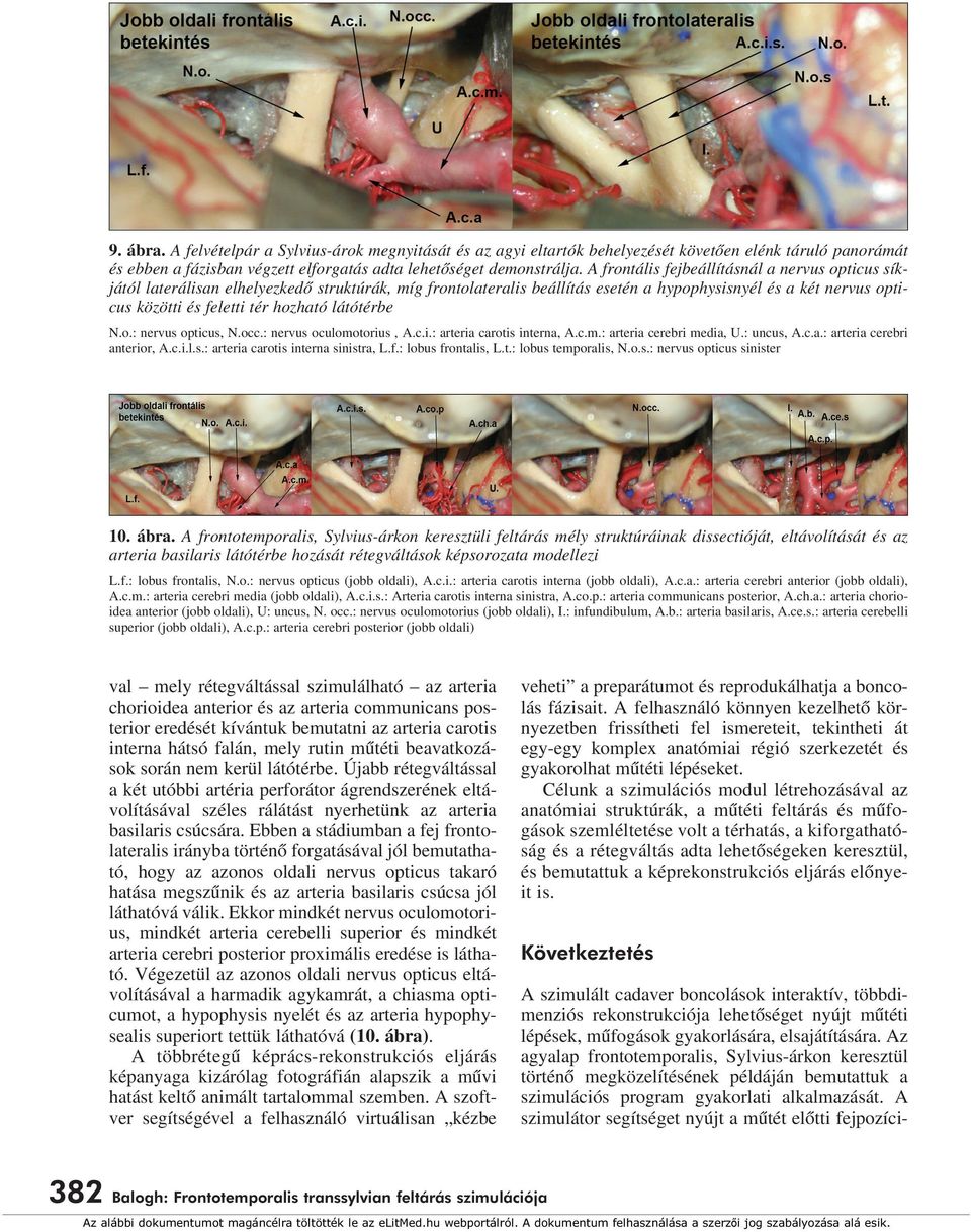 látótérbe N.o.: nervus opticus, N.occ.: nervus oculomotorius, A.c.i.: arteria carotis interna, A.c.m.: arteria cerebri media, U.: uncus, A.c.a.: arteria cerebri anterior, A.c.i.l.s.: arteria carotis interna sinistra, L.