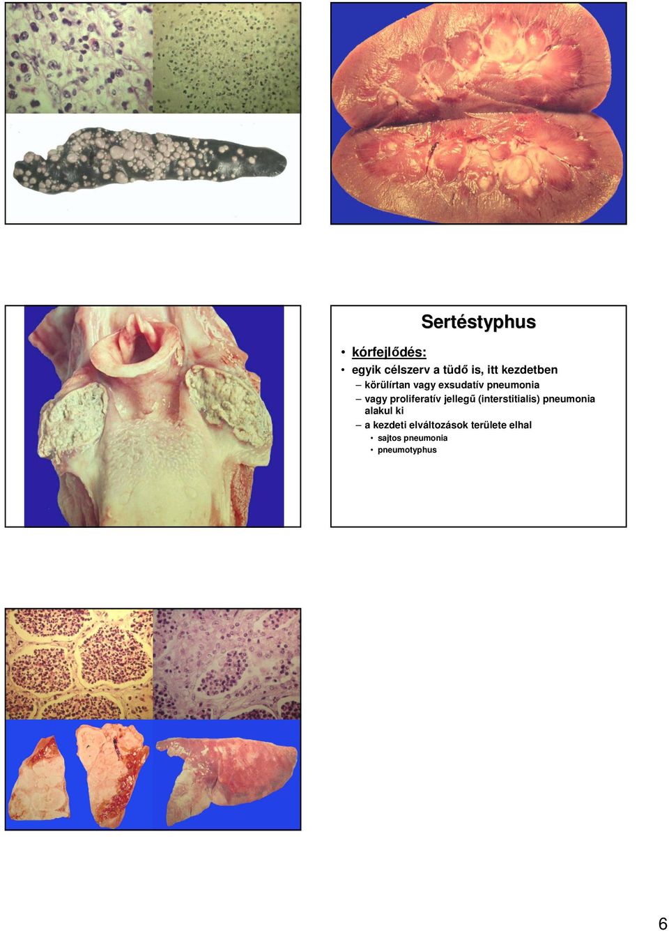 (interstitialis) pneumonia alakul ki a kezdeti