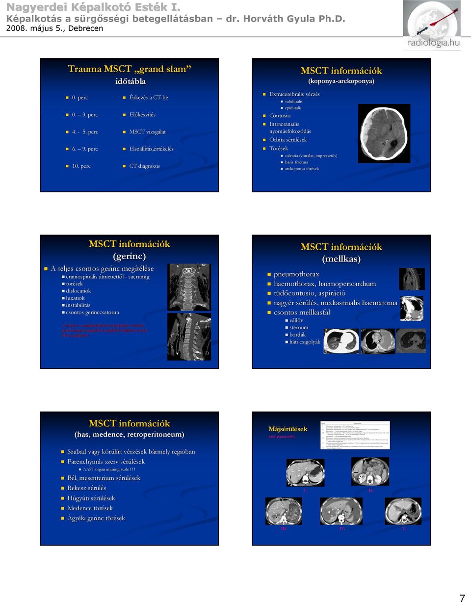 információk (koponya-arckoponya) arckoponya) calvaria (vonalas, impressziós) basis fractura arckoponya törések MSCT információk (gerinc) A teljes csontos gerinc megítélése craniospinalis átmenettől -