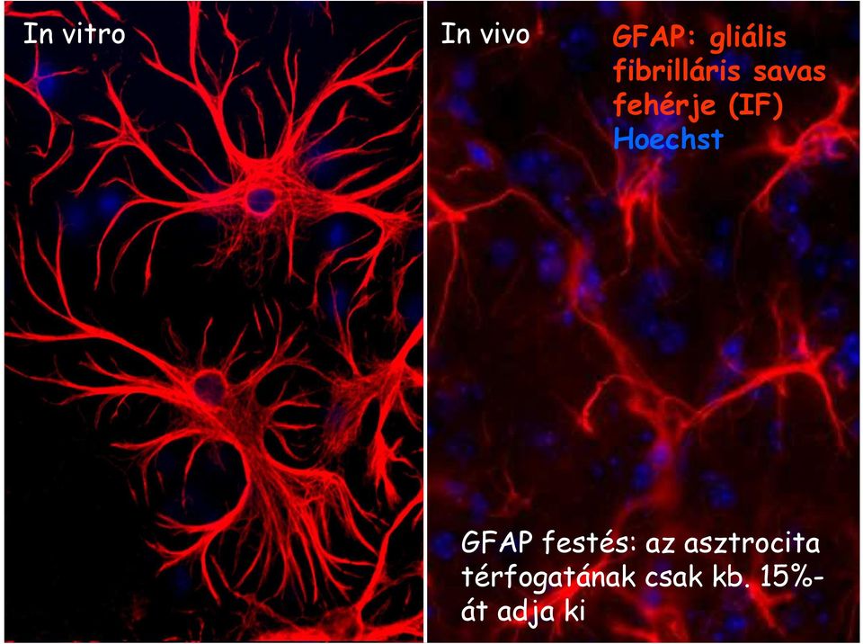 Hoechst GFAP festés: az