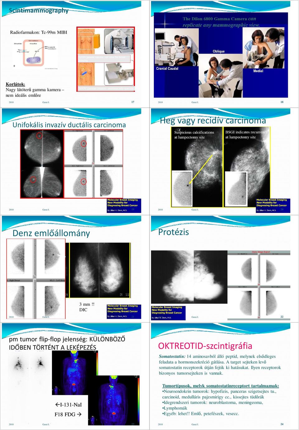 ! DIC 21 pm tumor flip-flop jelenség: KÜLÖNBÖZŐ IDŐBEN TÖRTÉNT A LEKÉPEZÉS OKTREOTID-szcintigráfia Somatostatin: 14 aminosavból álló peptid, melynek elsıdleges feladata a hormonszekréció gátlása.