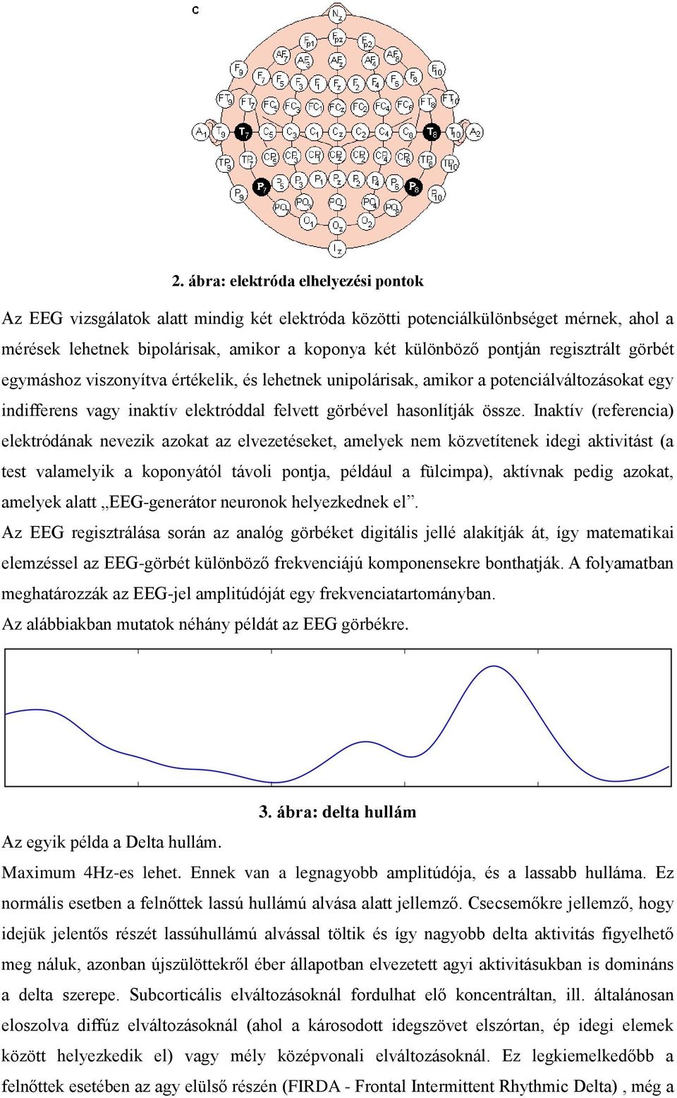 Inaktív (referencia) elektródának nevezik azokat az elvezetéseket, amelyek nem közvetítenek idegi aktivitást (a test valamelyik a koponyától távoli pontja, például a fülcimpa), aktívnak pedig azokat,