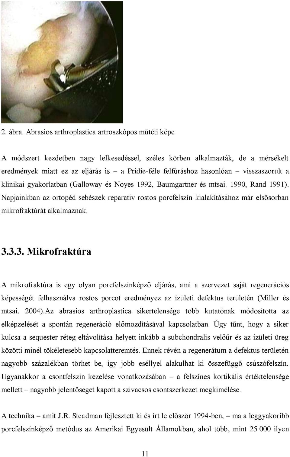 hasonlóan visszaszorult a klinikai gyakorlatban (Galloway és Noyes 1992, Baumgartner és mtsai. 1990, Rand 1991).