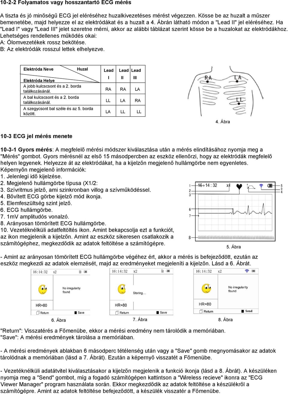 Ha "Lead I" vagy "Lead III" jelet szeretne mérni, akkor az alábbi táblázat szerint kösse be a huzalokat az elektródákhoz. Lehetséges rendellenes működés okai: A: Ólomvezetékek rossz bekötése.