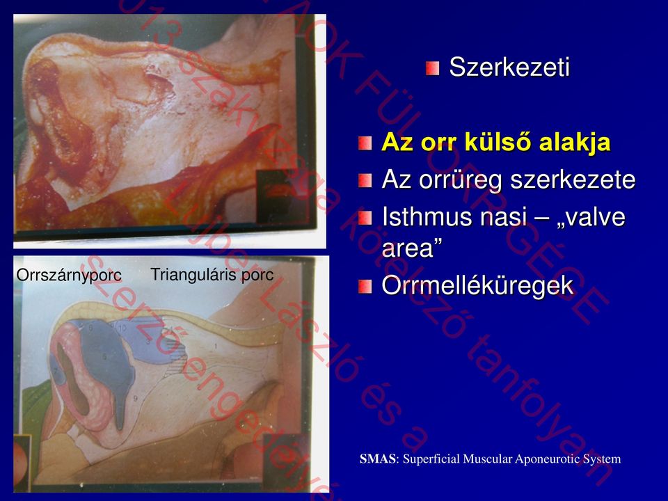 Isthmus nasi valve area Orrmelléküregek