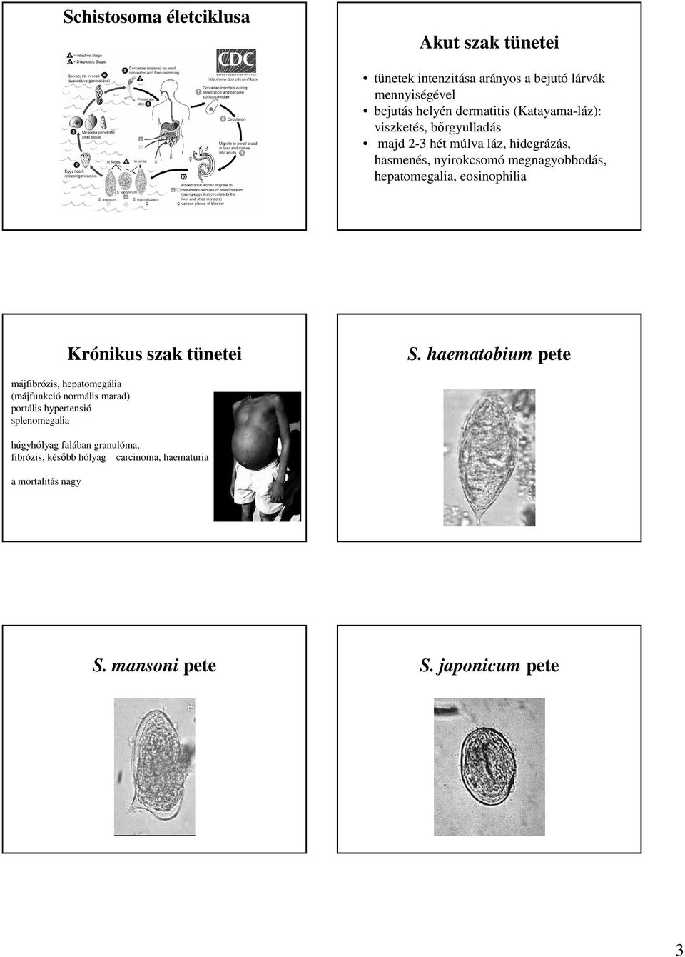 eosinophilia Krónikus szak tünetei S.