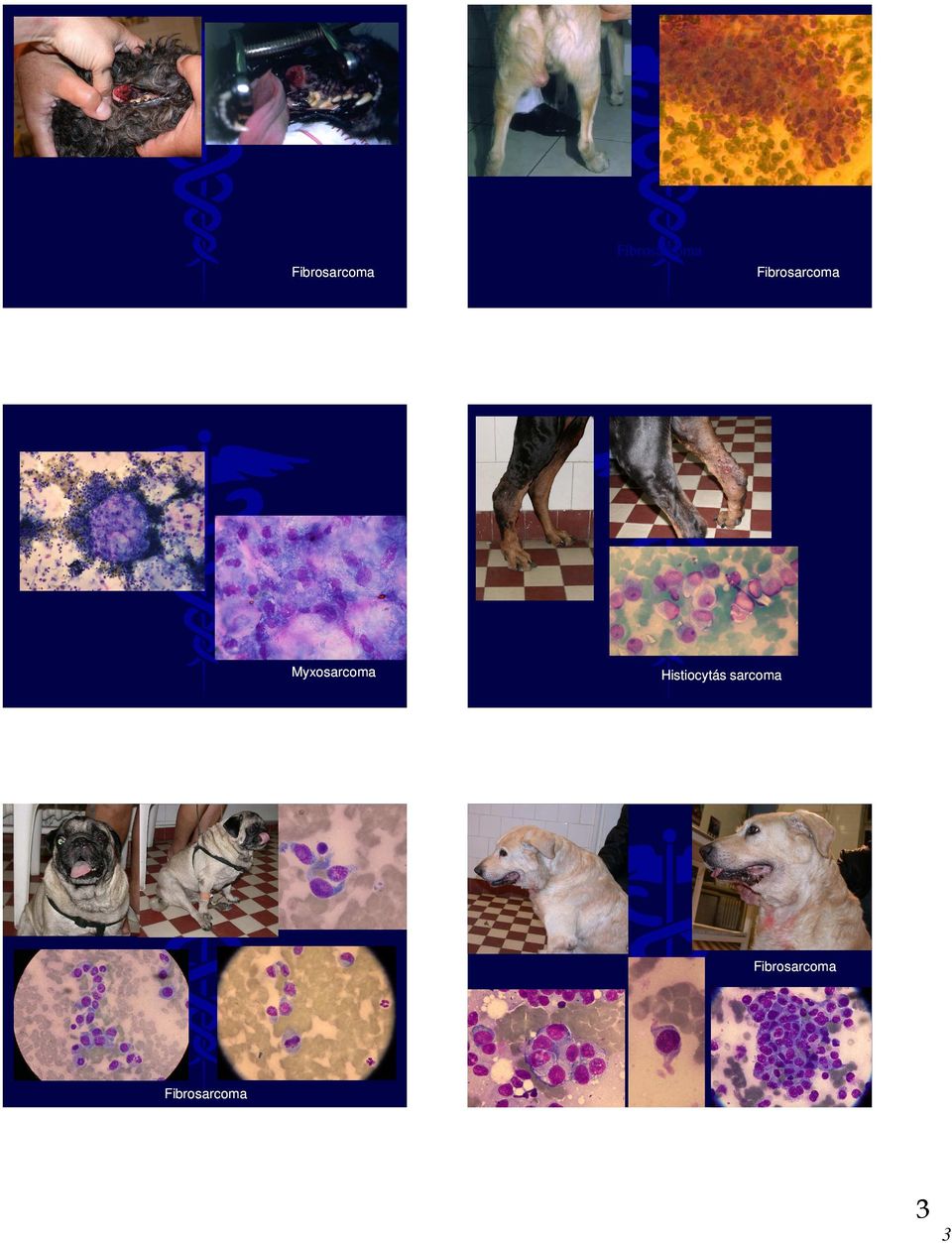 sarcoma   3 3