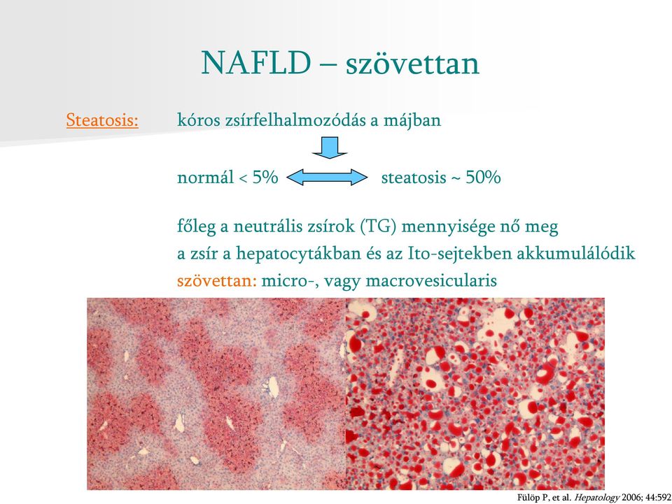 zsír a hepatocytákban és az Ito-sejtekben akkumulálódik szövettan: