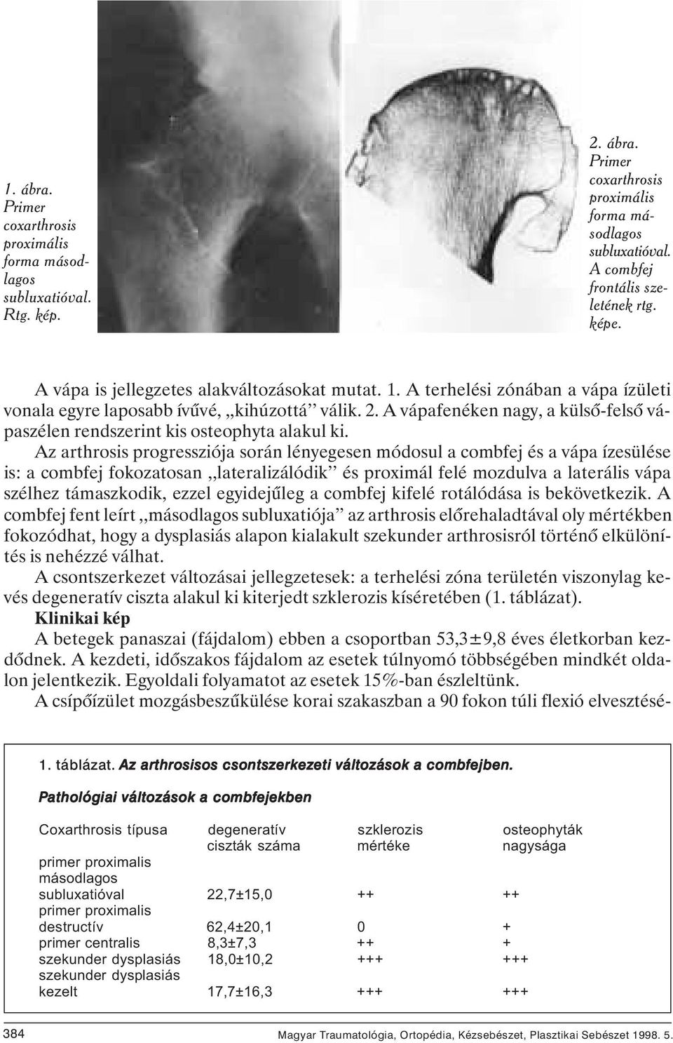 A vápafenéken nagy, a külsô-felsô vápaszélen rendszerint kis osteophyta alakul ki.