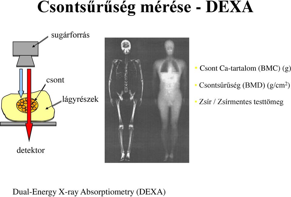 Csontsűrűség (BMD) (g/cm 2 ) Zsír / Zsírmentes
