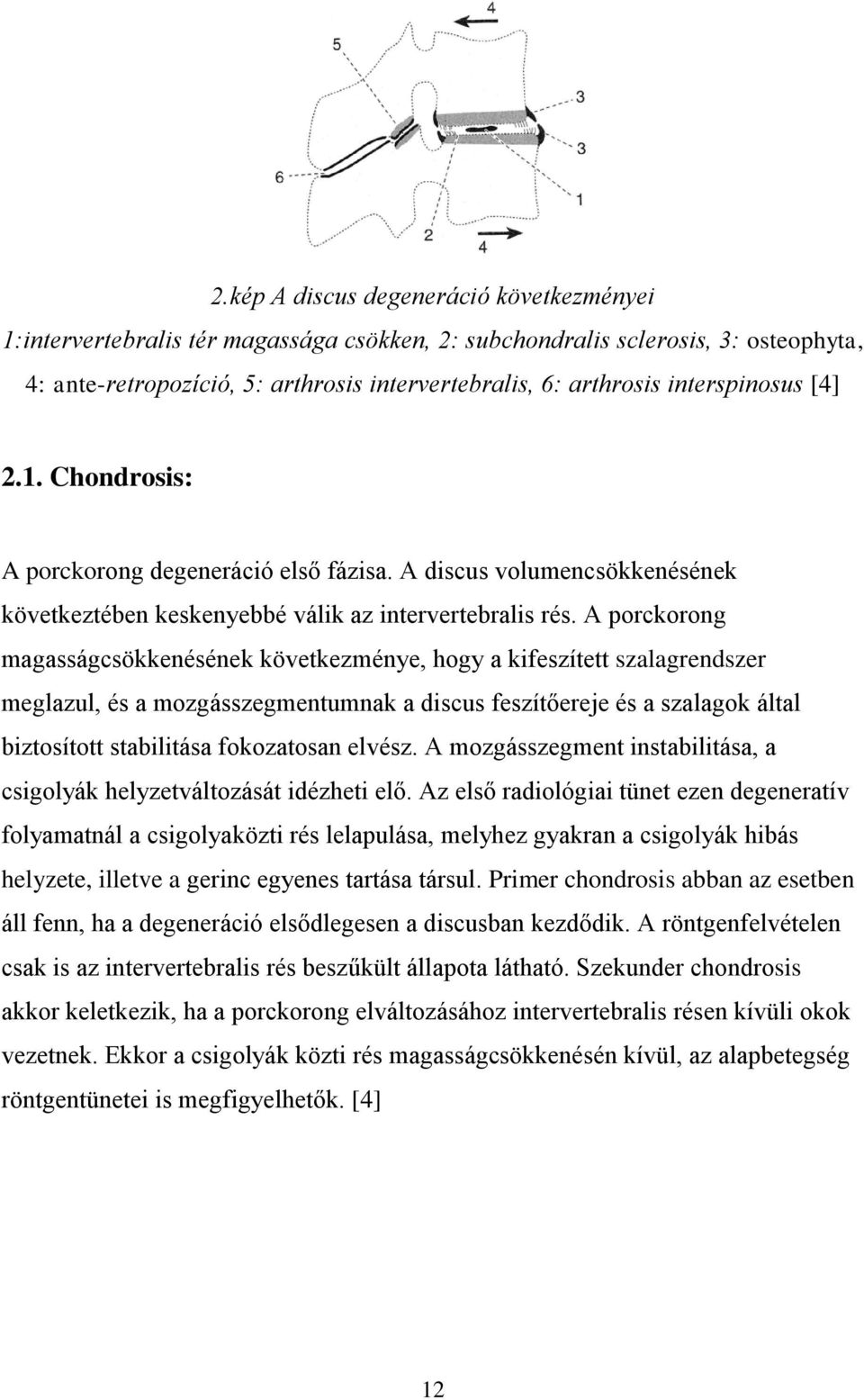 A porckorong magasságcsökkenésének következménye, hogy a kifeszített szalagrendszer meglazul, és a mozgásszegmentumnak a discus feszítőereje és a szalagok által biztosított stabilitása fokozatosan