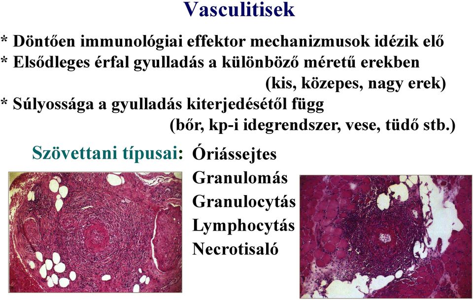 * Súlyossága a gyulladás kiterjedésétől függ (bőr, kp-i idegrendszer, vese,