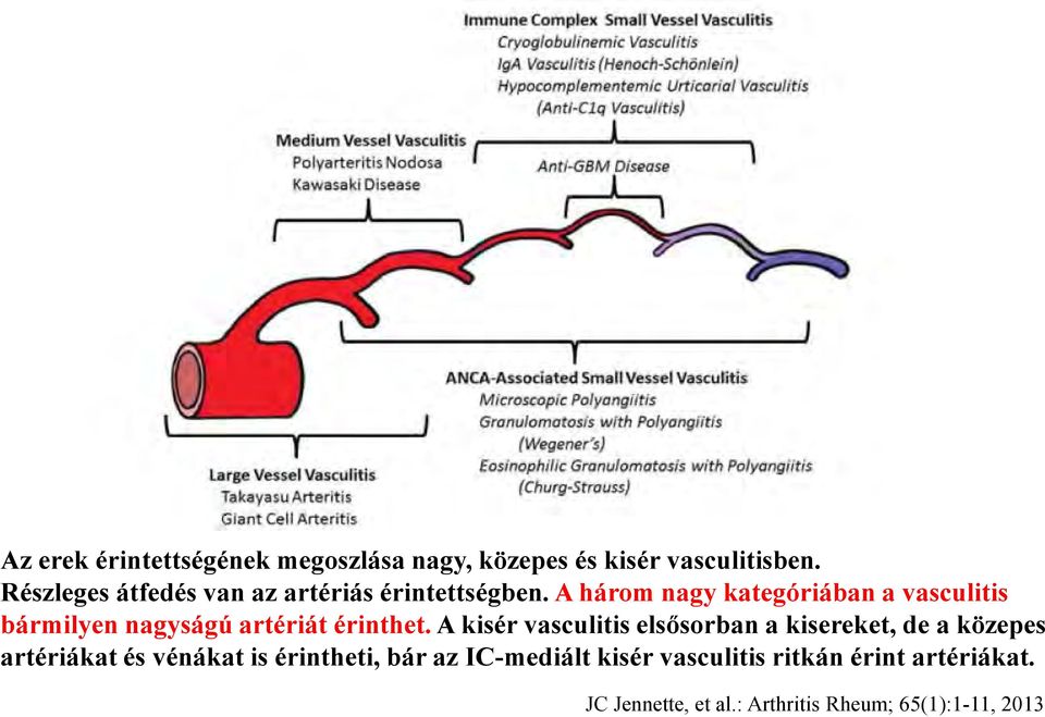 A három nagy kategóriában a vasculitis bármilyen nagyságú artériát érinthet.