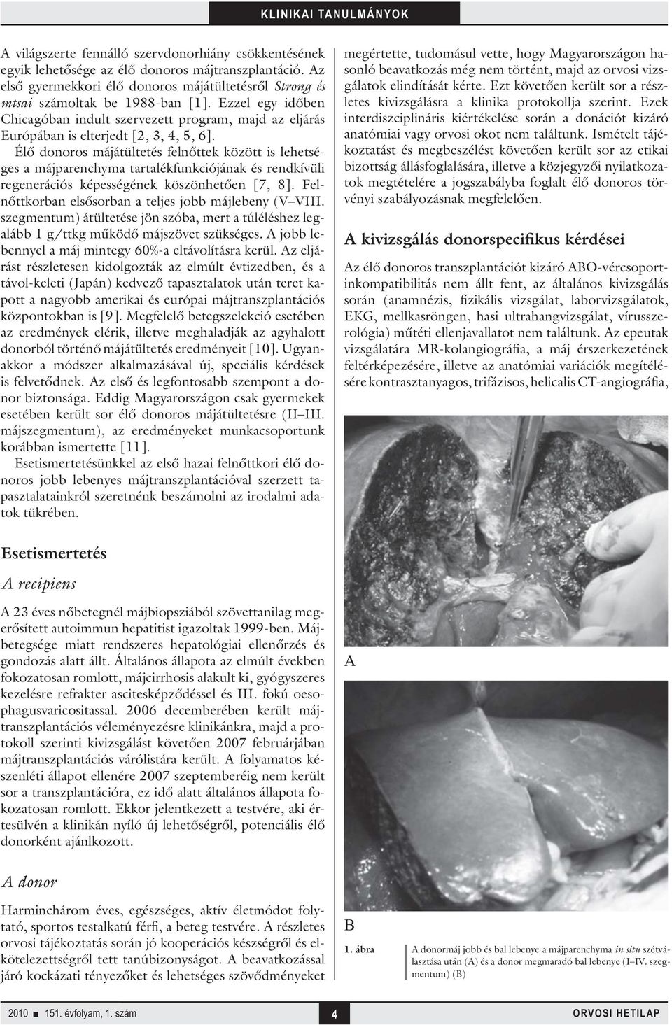 Élő donoros májátültetés felnőttek között is lehetséges a májparenchyma tartalékfunkciójának és rendkívüli regenerációs képességének köszönhetően [7, 8].