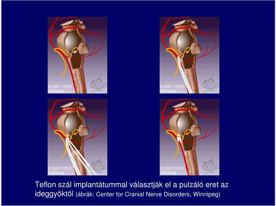 az ideggyöktől (ábrák: Center