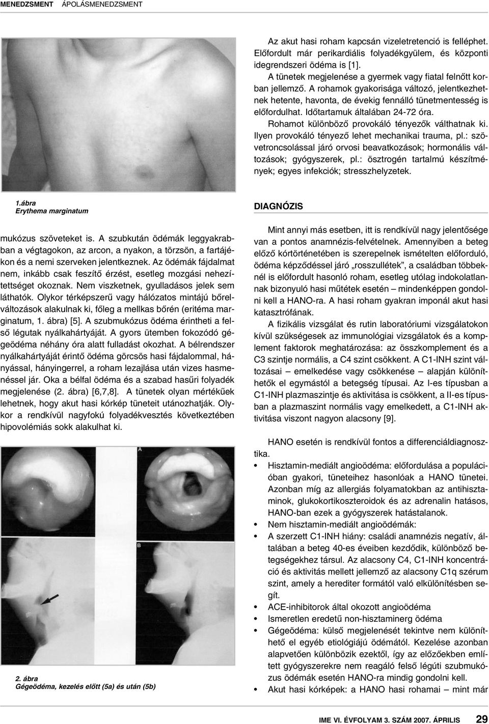 Idôtartamuk általában 24-72 óra. Rohamot különbözô provokáló tényezôk válthatnak ki. Ilyen provokáló tényezô lehet mechanikai trauma, pl.