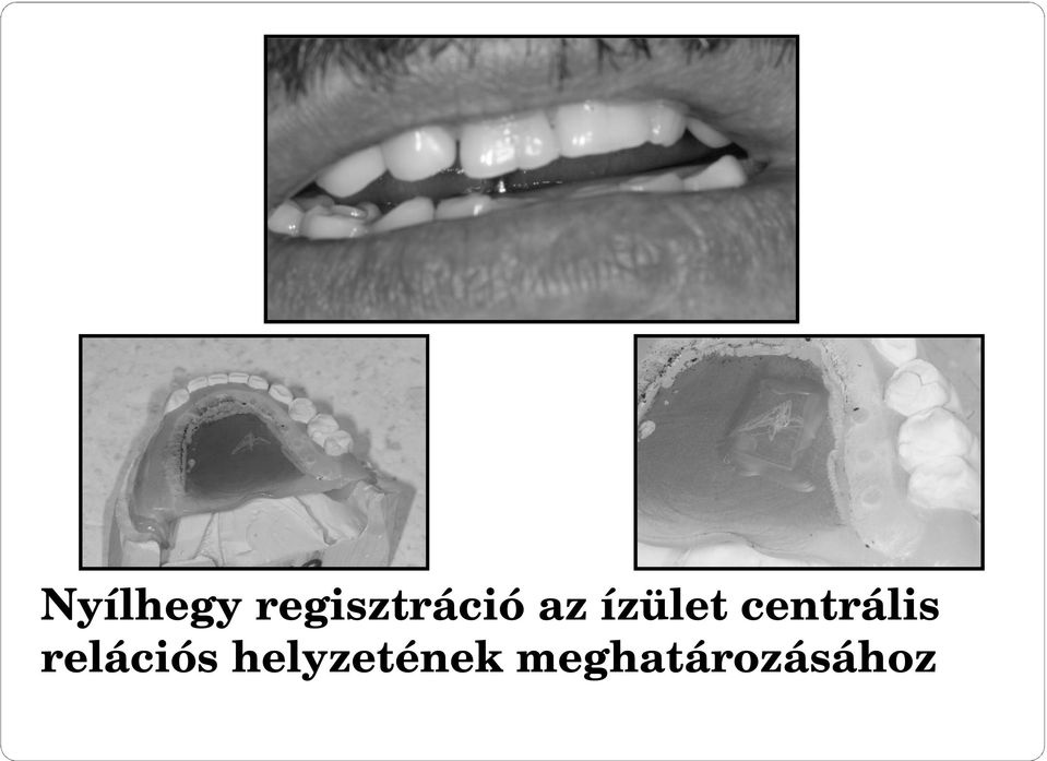 ízület centrális