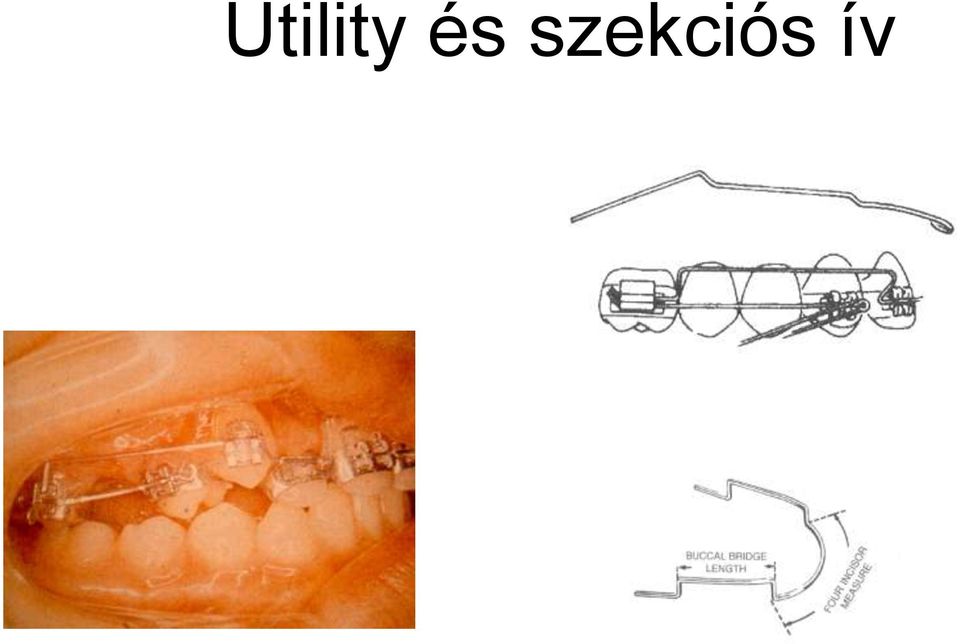 szekciós