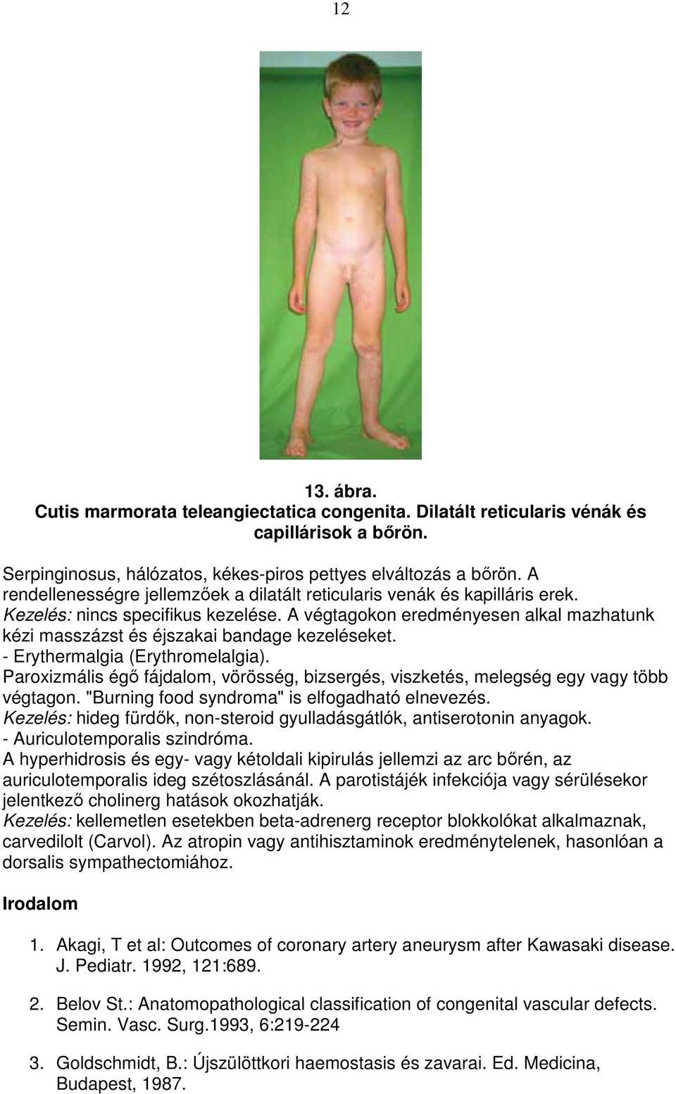 A végtagokon eredményesen alkal mazhatunk kézi masszázst és éjszakai bandage kezeléseket. - Erythermalgia (Erythromelalgia).