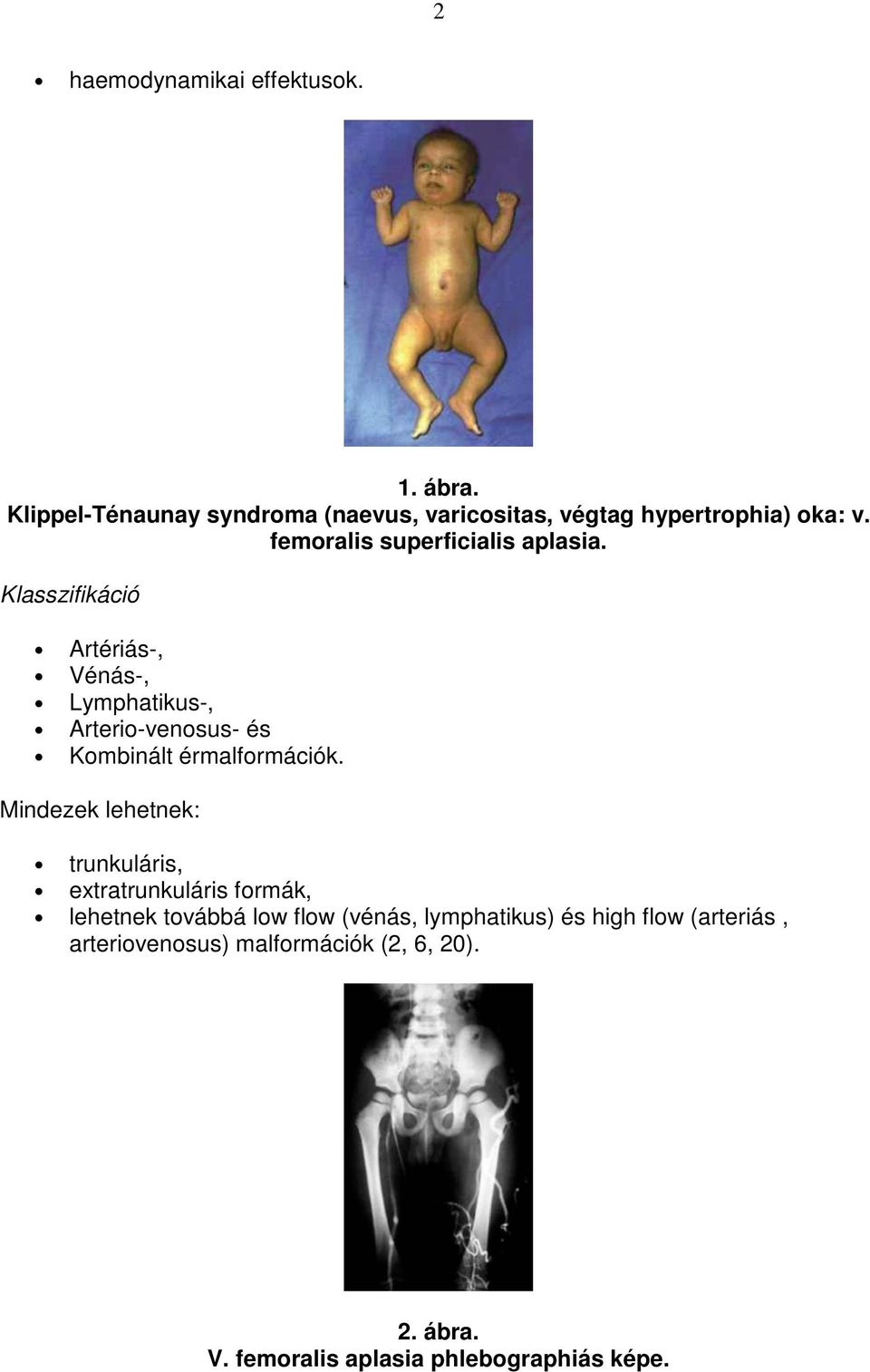 Klasszifikáció Artériás-, Vénás-, Lymphatikus-, Arterio-venosus- és Kombinált érmalformációk.