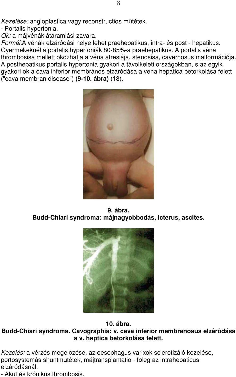 A posthepatikus portalis hypertonia gyakori a távolkeleti országokban, s az egyik gyakori ok a cava inferior membrános elzáródása a vena hepatica betorkolása felett ("cava membran disease") (9-10.