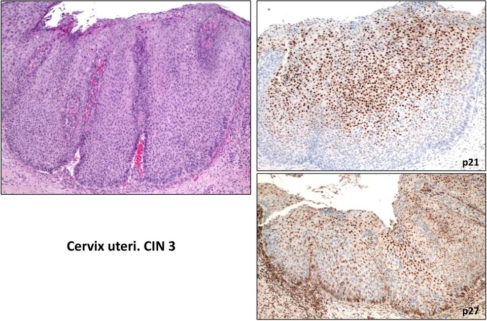 uteri.