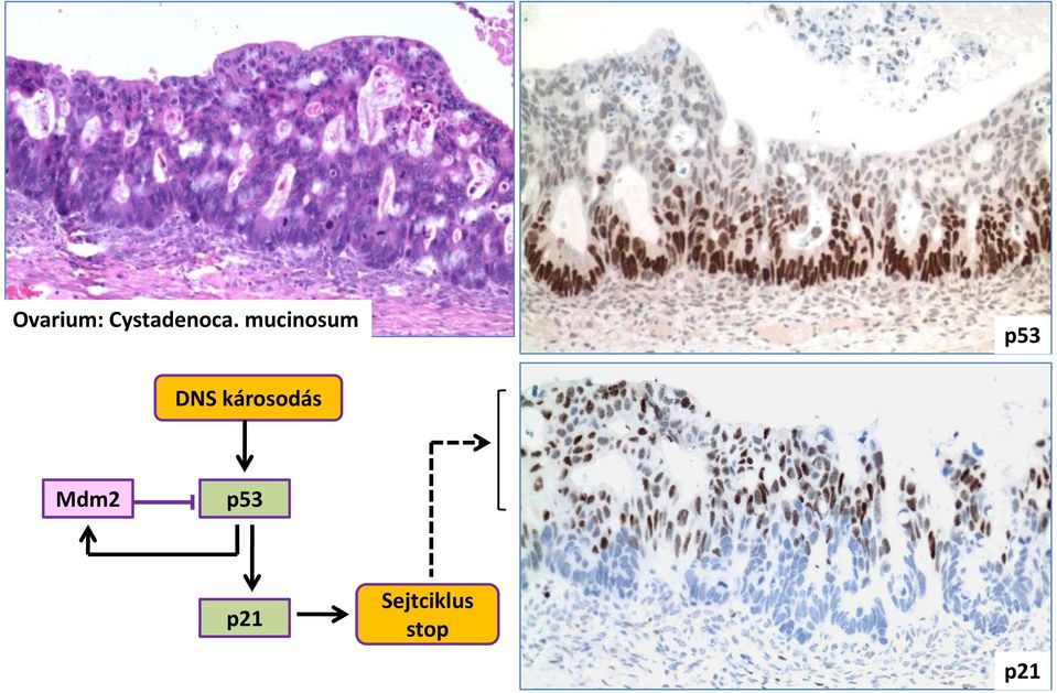 károsodás Mdm2 p53